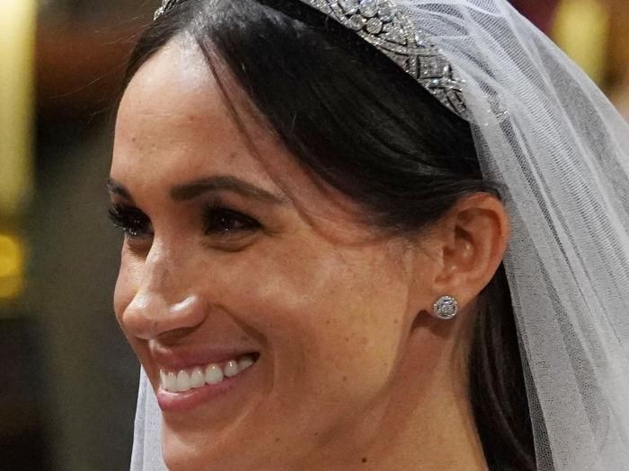 Bibir Meghan Markle. Foto: Getty Images Bibir Meghan Markle. Foto: Getty Images