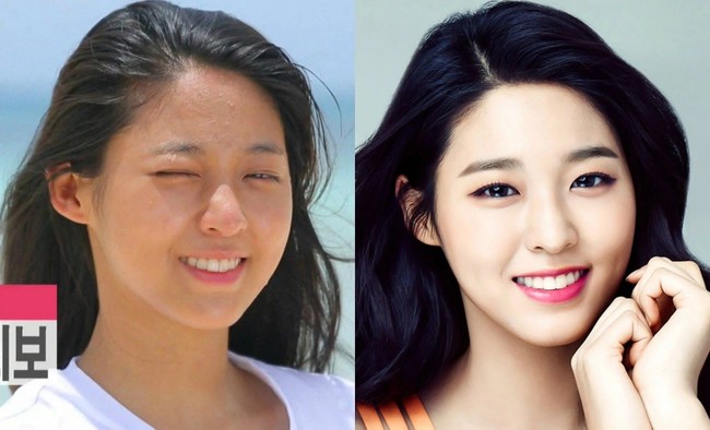 Tanpa makeup, wajah Seolhyun AOA terlihat kusam dan nampak beberapa jerawat kecil di keningnya.  Foto: ist.