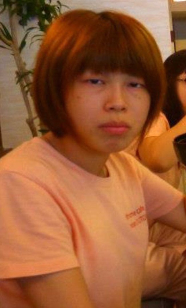 Sebagian wanita punya obesesi tersendiri terhadap standar kecantikan yang dimilikinya. Sehingga tak heran beberapa memilih operasi plastik untuk mengubah bentuk wajahnya menjadi lebih cantik dan menarik. Seperti yang dilakukan oleh wanita asal Jepang ini, yang rela menghabiskan banyak uang untuk operasi plastik. Foto: Twitter