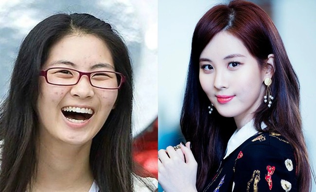 Seohyun dari grup vokal SNSD tampak jauh berbeda penampilannya ketika memiliki masalah kulit wajah dengan timbulnya bintik hitam di pipi bekas jerawat. Foto: ist.