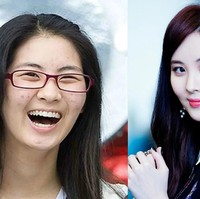 Seohyun dari grup vokal SNSD tampak jauh berbeda penampilannya ketika memiliki masalah kulit wajah dengan timbulnya bintik hitam di pipi bekas jerawat. Foto: ist.