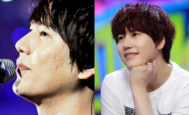 Super Junior Kyuhyun juga sempat mempunyai masalah pada kulit wajahnya. Bekas jerawat yang timbul membuat pori-pori kulig pipi Kyuhyun nampak membesar.  Foto: ist.