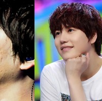 Super Junior Kyuhyun juga sempat mempunyai masalah pada kulit wajahnya. Bekas jerawat yang timbul membuat pori-pori kulig pipi Kyuhyun nampak membesar.  Foto: ist.