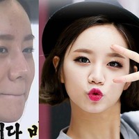 Girls Day Hyeri pernah memiliki beberapa bekas jerawat yang terlihat di kening dan pipinya. Foto: ist.