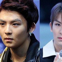 Ricky dari boy band Teen Top memiliki masalah kulit wajah dengan timbulnya jerawat kecil-kecil.  Foto: ist.