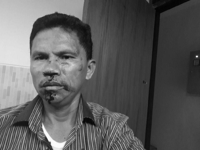 Sudah Jatuh Tertimpa Tangga, Hitler Dikeroyok dan Disanksi Partai Sudah Jatuh Tertimpa Tangga, Hitler Dikeroyok dan Disanksi Partai