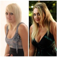 Aku dibuat merasa berbeda karena penampilan dan aku sering menangis karena aku tidak bisa terlihat normal karena anak-anak lelaki itu. Aku tidak pernah melihat diriku sebagai orang yang jelek, aku hanya tahu aku berbeda dan tidak senang dengan penampilanku, tambahnya. Foto: Instagram Laura Hawkes