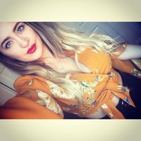 Operasi terbesarku adalah operasi rahang ganda di mana mereka memotong kedua sisi rahang, menariknya ke depan dan menempatkannya kembali ke posisi, rahangku lalu diikat dengan kawat gigi agar tidak berubah posisi, tutur Laura. Foto: Instagram Laura Hawkes