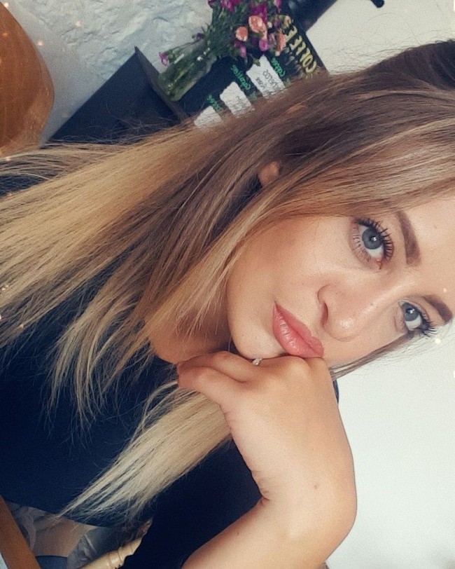 Ketika kecil, aku tidak pernah dibuat merasa berbeda oleh keluarga dan teman-temanku karena sumbingku tidak pernah jadi pembicaraan besar, tapi di sekolah berbeda karena itu ditonjolkan oleh anak-anak lelaki yang menindasku karena hidung dan wajah yang datar, kata Laura Hawkes dilansir Dailymail. Foto: Instagram Laura Hawkes