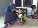 Puluhan Anak di Purwakarta Diduga Terjangkit Virus Flu Singapura