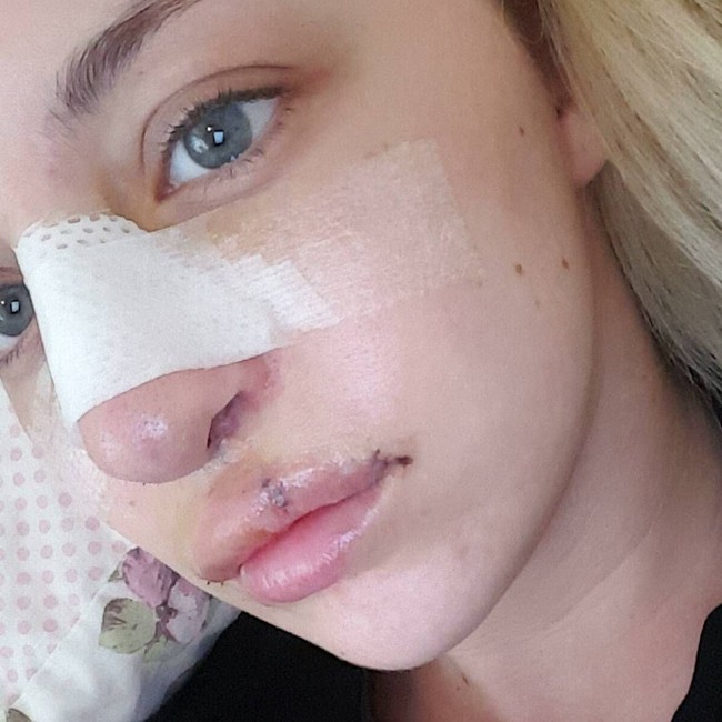 Apalagi perlakuan tidak menyenangkan itu telah membuatnya kurang percaya diri dan sering bersembunyi dari interaksi sosial saat remaja. Foto: Instagram Laura Hawkes