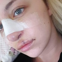 Apalagi perlakuan tidak menyenangkan itu telah membuatnya kurang percaya diri dan sering bersembunyi dari interaksi sosial saat remaja. Foto: Instagram Laura Hawkes