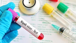 Virus Nipah Dikhawatirkan Jadi Pandemi Baru di Asia