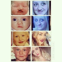 Seorang wanita bernama Laura Hawkes yang lahir dengan kondisi bibir sumbing mengalami pengalaman tidak menyenangkan sepanjang masa kecilnya. Laura sering menerima ledekan mengenai keadaan tubuhnya itu. Foto: Instagram Laura Hawkes