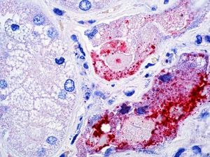 Soal Virus Nipah, Pakar UGM Sebut Semua Virus Berpotensi Jadi Pandemi Baru