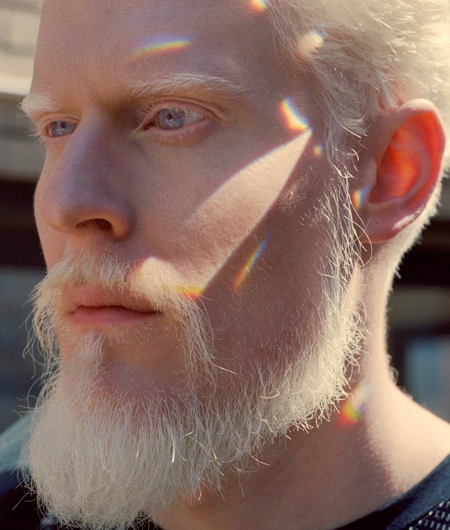 Kondisi kulit albino tak menjadi halangan bagi Stephen Thompson untuk berkarier sebagai model. Apalagi dengan wajahnya yang sangat tampan. Foto: Instagram