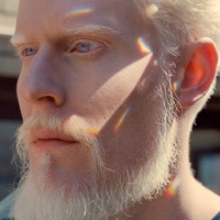 Kondisi kulit albino tak menjadi halangan bagi Stephen Thompson untuk berkarier sebagai model. Apalagi dengan wajahnya yang sangat tampan. Foto: Instagram