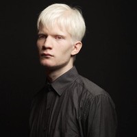 Pria 19 tahun ini adalah Amal Sofi, model albino asal Rusia yang berwajah tampan. Foto: Instagram