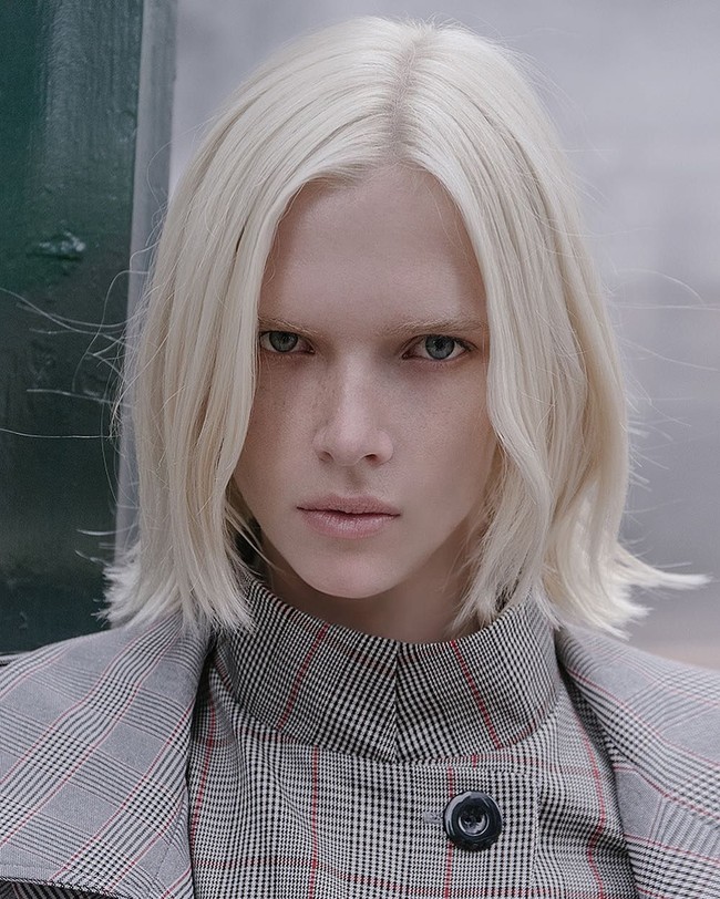 Alyona Subbotina sekilas mungkin tak terlihat mengidap albino. Selain berprofesi sebagai model, wanita asal Kazakstan ini juga merupakan seorang pebisnis. Foto: Instagram