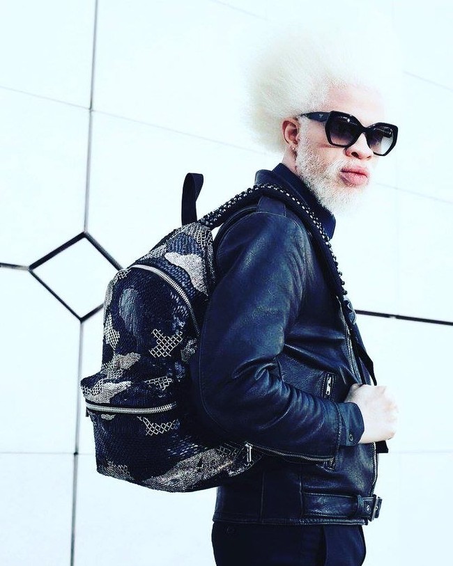 Jewell Jeffrey adalah model albio Afrika-Amerika lain yang eksis di industri fashion. Selain jadi model, Jewell juga merupakan seorang DJ. Foto: Instagram