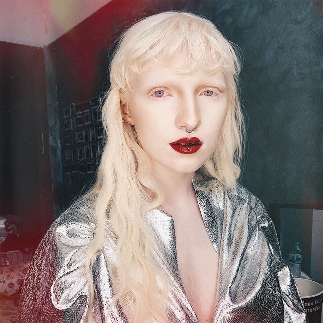 Nama Nastya Zhidkova cukup dikenal di industri fashion. Dulu sempat di-bully karena kondisi kulitnya, kini wanita bermata indah itu sukses menjadikan keunikannya sebagai keunggulan. Foto: Instagram