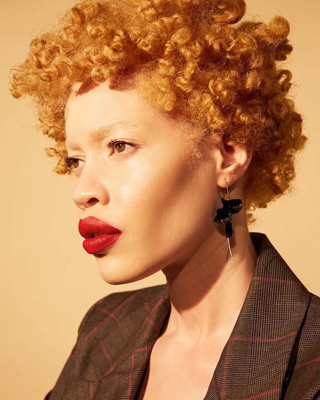 Diandra Forrest adalah model yang juga advokat untuk anak muda albino di Tanzania. Foto: Instagram