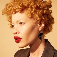 Diandra Forrest adalah model yang juga advokat untuk anak muda albino di Tanzania. Foto: Instagram