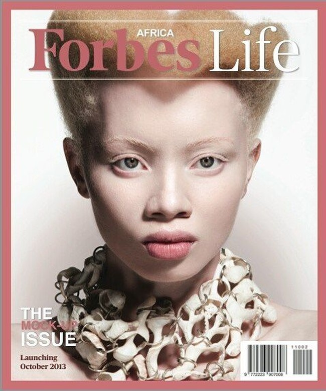 Karena keunikkannya, wajah model Thando Hopa pernah menghiasi sampul majalah Forbes Afrika Selatan. Model sekaligus pengacara tersebut pun berharap bisa mengubah persepsi orang mengenai albinisme. Foto: Instagram