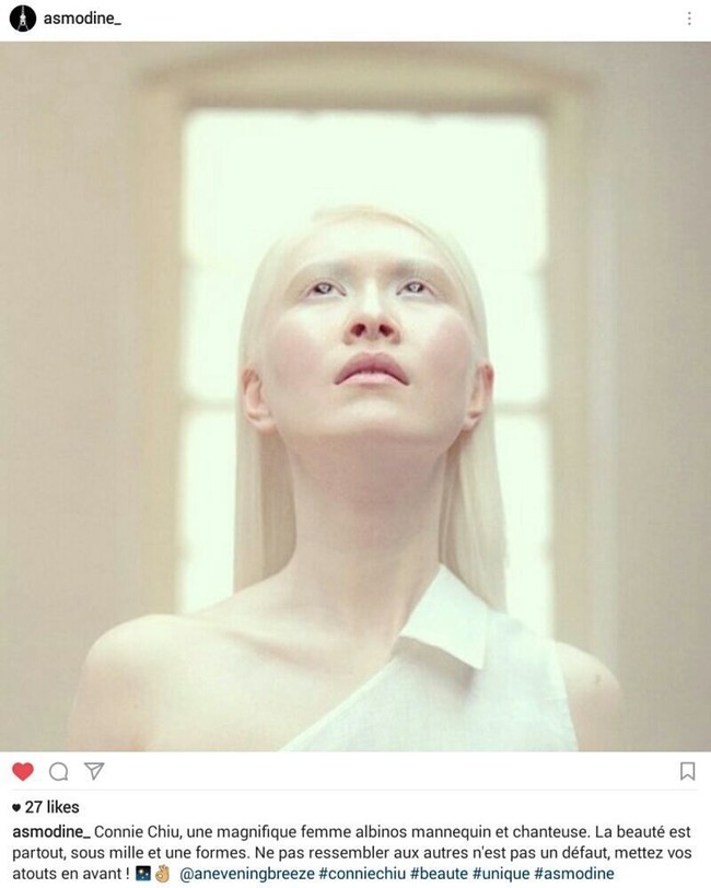 Connie Chiu dikatakan sebagai model fashion pertama dengan albinisme. Wanita asal Hong Kong yang dibesarkan di Swedia itu pergi ke London untuk menjadi model profesional.  Foto: Instagram