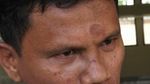 Before After Wajah Hitler yang Dikeroyok Gegara Pesawat Pengintai