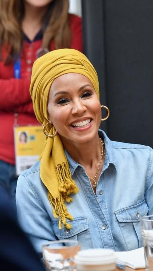 Aktris 46 tahun itu mengaku mengalami kerontokan parah yang menghilangkan banyak rambutnya. Kondisi tersebut bisa dibilang alopecia, yakni penyakit kulit autoimun yang menyebabkan kerontakan rambut di kulit kepala, wajah dan area tubuh yang berbulu lainnya. Foto: Getty Images