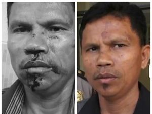 Before After Wajah Hitler yang Dikeroyok Gegara Pesawat Pengintai