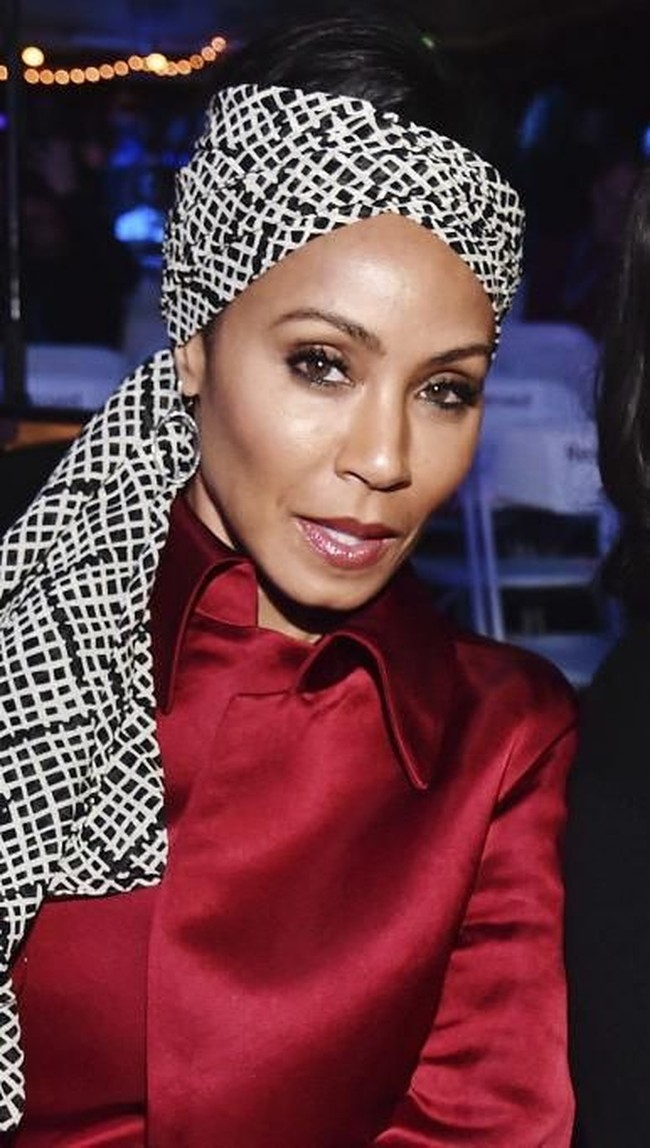 Kini Jada bisa lebih menerima kondisinya dan percaya diri dengan penampilan barunya. Saat rambut tertutupi, aku merasa seperti ratu, katanya. Foto: Getty Images