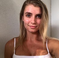 Beck Jackson tak takut menunjukkan bahwa wajahnya tak sempurna. Ia pun sering membagi foto selfie tanpa filter yang menunjukkan kondisi kulit berjerawat. Foto: Instagram @becklomas