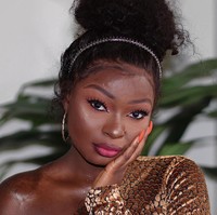 Shalom Blac sempat di-bully karena kulitnya yang penuh dengan luka bakar. Namun ia menemukan kepercayaan diri berkat makeup. Kini ia pun sukses jadi seorang beauty blogger. Foto: Instagram @shalom_blac  