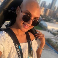 Rambut adalah mahkota bagi banyak wanita. Tapi tanpa mahkota itu pun Yasmin Taylor tetap percaya diri. Blogger yang mengalami alopecia itu bahkan menginspirasi wanita lain untuk tetap percaya diri dan semangat menumbuhkan rambut. Foto: Instagram @yasmintaylor5