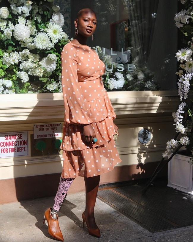 Selebgram berikut ini dikenal dengan gaya berpakaian yang stylish. Walau kehilangan satu kaki dan menggunakan kaki palsu, Cacsmy Brutus tetap percaya diri dan tampil fashionable. Foto: Instagram @mamacaxx