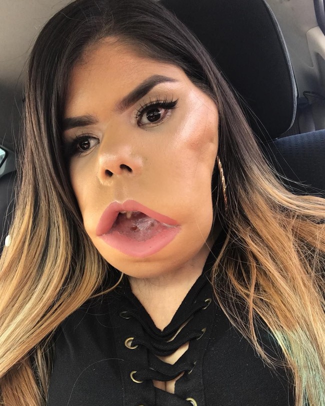 Marimar Quiroa lahir dengan cystic hygroma yakni tumor di leher yang membuatnya sulit bernapas dan berbicara. Meski harus berkomunikasi menggunakan bahasa isyarat, itu tak menghalanginya berbagi tips kecantikan kepada para pengikut di Instagram. Foto: Instagram @makeupartistgorda66