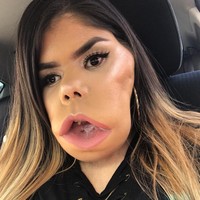 Marimar Quiroa lahir dengan cystic hygroma yakni tumor di leher yang membuatnya sulit bernapas dan berbicara. Meski harus berkomunikasi menggunakan bahasa isyarat, itu tak menghalanginya berbagi tips kecantikan kepada para pengikut di Instagram. Foto: Instagram @makeupartistgorda66