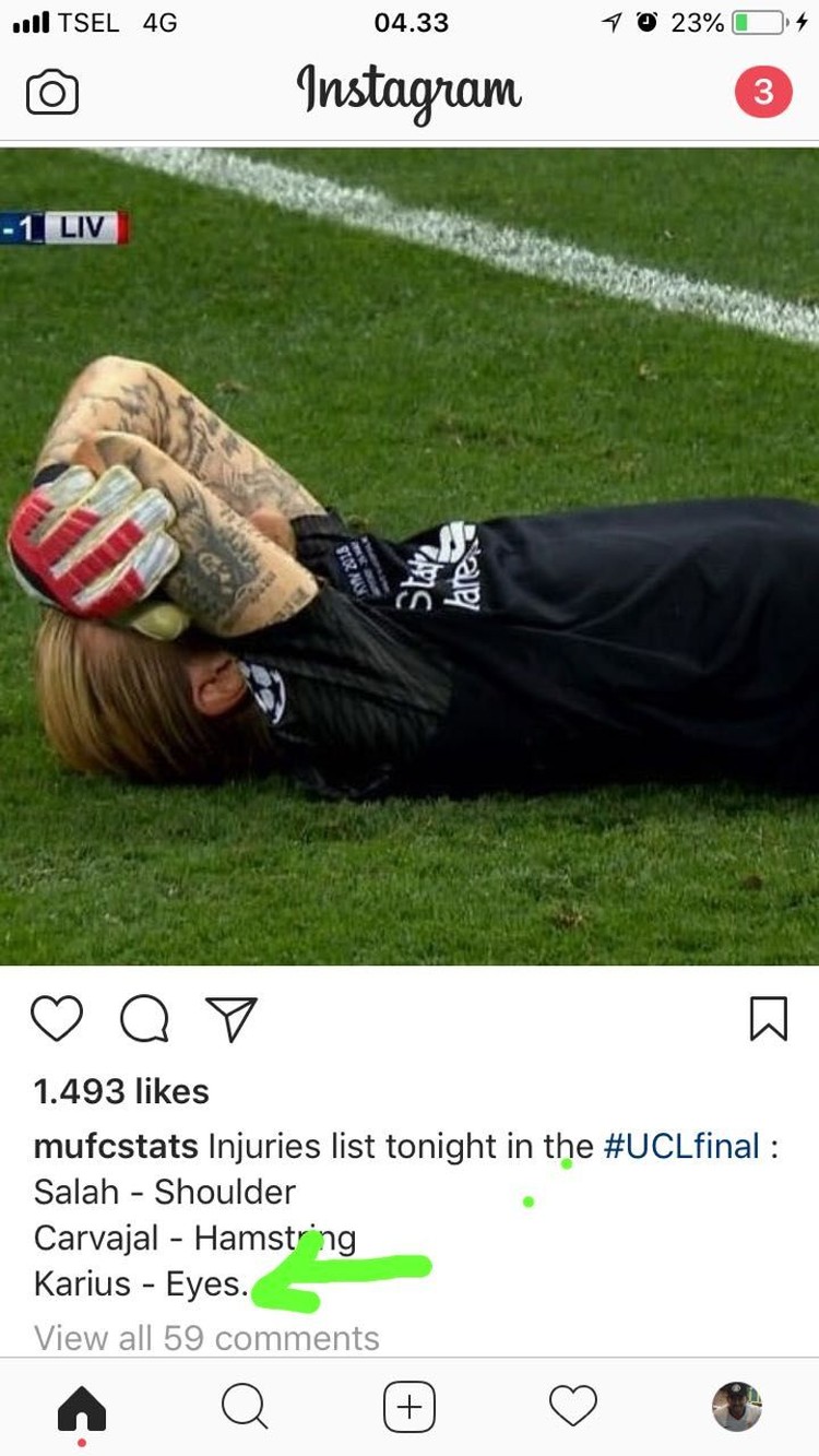 Meme Bahagia Bale Vs Tangis Derita Karius Foto 16