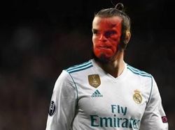 Meme Bahagia Bale vs Tangis Derita Karius