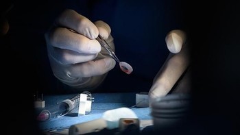 Seorang dokter yang menangani operasi transplantasi kornea Diana, sedang mempersiapkan operasi. Leon Neal/Getty Images.