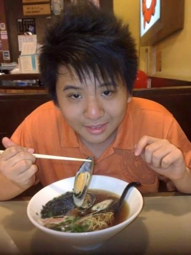 Steve Yong membagikan perjalanan operasi plastiknya di media sosial. Foto: Facebook Steven Yong