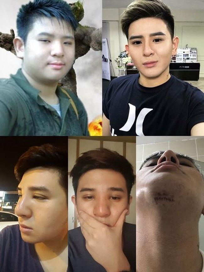 Pria asal Malaysia itu mengaku melakukan operasi kelopak mata, rhinoplasty atau operasi hidung, dan operasi dagu untuk terlihat lebih tampan. Foto: Facebook Steven Yong