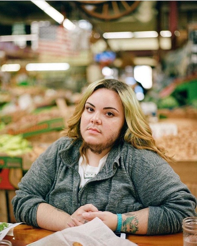 Umumnya wanita yang memiliki bulu lebat tumbuh di dada hingga rahang biasanya mengidap sindrom polycystic ovary syndrome (PCOS). Seperti dialami Alma Torres, fotografer asal Amerika Serikat yang tubuh dan wajahnya ditumbuhi bulu. Penampilannya bak pria dengan jenggot. Awalnya Alma tak percaya diri dengan kondisinya hingga terus mencukur bulu-bulu di tubuhnya. Tapi Alma kini memutuskan menumbuhkan bulu-bulu di tubuhnya tanpa lagi mencukurnya. Wanita 24 tahun itu telah menemukan kepercayaan diri bahkan ia memiliki kekasih yang bisa menerima kekurangannya.  Foto: Istimewa