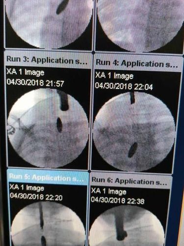 Jika tidak dikeluarkan, bisa membahayakan saluran napas.