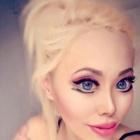 Ia menjalani operasi mata dan hidung. Ophelia juga melakukan botox di banyak bagian wajahnya serta filler bibir. Foto: Dok. Instagram Ophelia Vanity