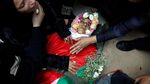 Peluru Tajam Tentara Israel Tebus Dada Ezz El-Deen