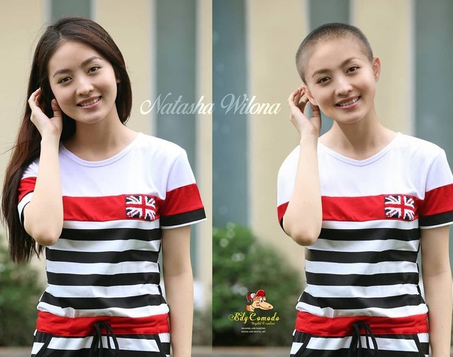 Tanpa rambut, Natasha Wilona jadi terlihat kurang segar dan seperti orang sakit. Mungkin karena tubuhnya yang kurus.  Foto: Instagram/@edycomodo