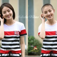 Tanpa rambut, Natasha Wilona jadi terlihat kurang segar dan seperti orang sakit. Mungkin karena tubuhnya yang kurus.  Foto: Instagram/@edycomodo